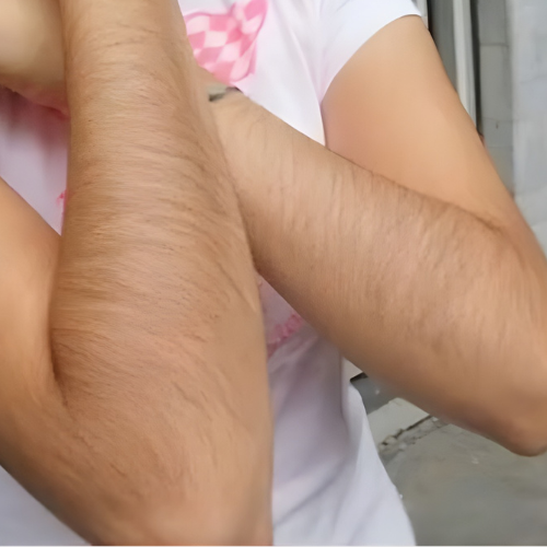 Pain-Free Hair Removal